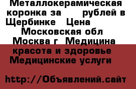 Металлокерамическая коронка за 7500 рублей в Щербинке › Цена ­ 7 500 - Московская обл., Москва г. Медицина, красота и здоровье » Медицинские услуги   